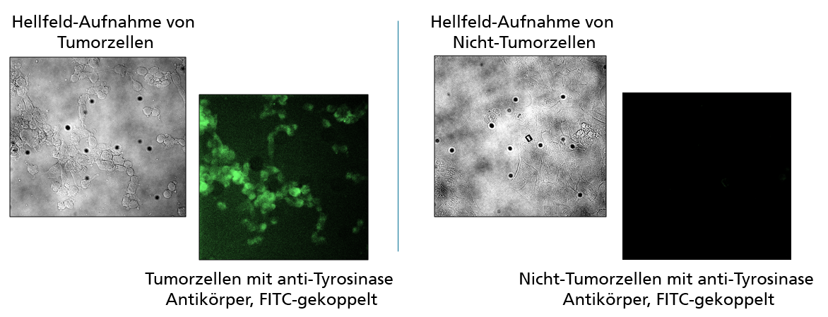Spezifische Färbung von Tumorgewebe mit Fluoresceinisothyocyanat (FITC)-gekoppelten Antikörpern